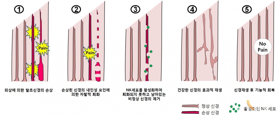 NK세포에 의한 손상된 신경 제거 및 재생 메커니즘. (사진=서울대 제공)