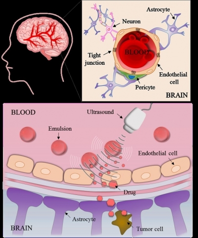 앤투비가 개발한 나노버블 약물 전달체가 뇌에 투과되는 모습을 형상화한 그림