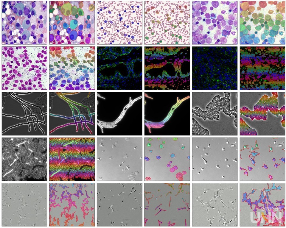그림 1. MEDIAR 기술로 세포를 인식한 예시. 다양한 상황에서 관찰된 현미경 이미지에서 MEDIAR 인공지능이 세포를 인식한 결과를 시각화하였다.