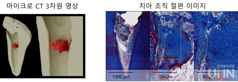 [그림] 동물 모델(개)을 활용한 치아 상아질 재생 유도 실험왼쪽: 옥시토신수용체 억제제를 처리 시 개의 치아 내부에 새롭게 생성된 치아조직 (붉은색)오른쪽: 치아 내부에 생성된 치아 상아질 유사구조를 가진 신생 경조직의 조직 사진