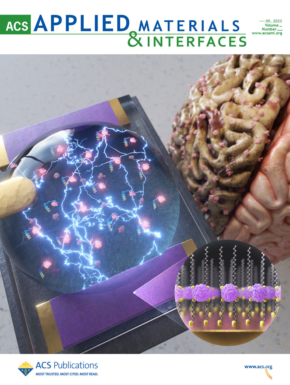 알츠하이머병 조기 진단용 고감도의 바이오센서의 모식도 (표지 선정 이미지)