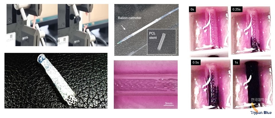 바이오프린팅 관상동맥을 이용한 스턴트 이식 시험 모습.