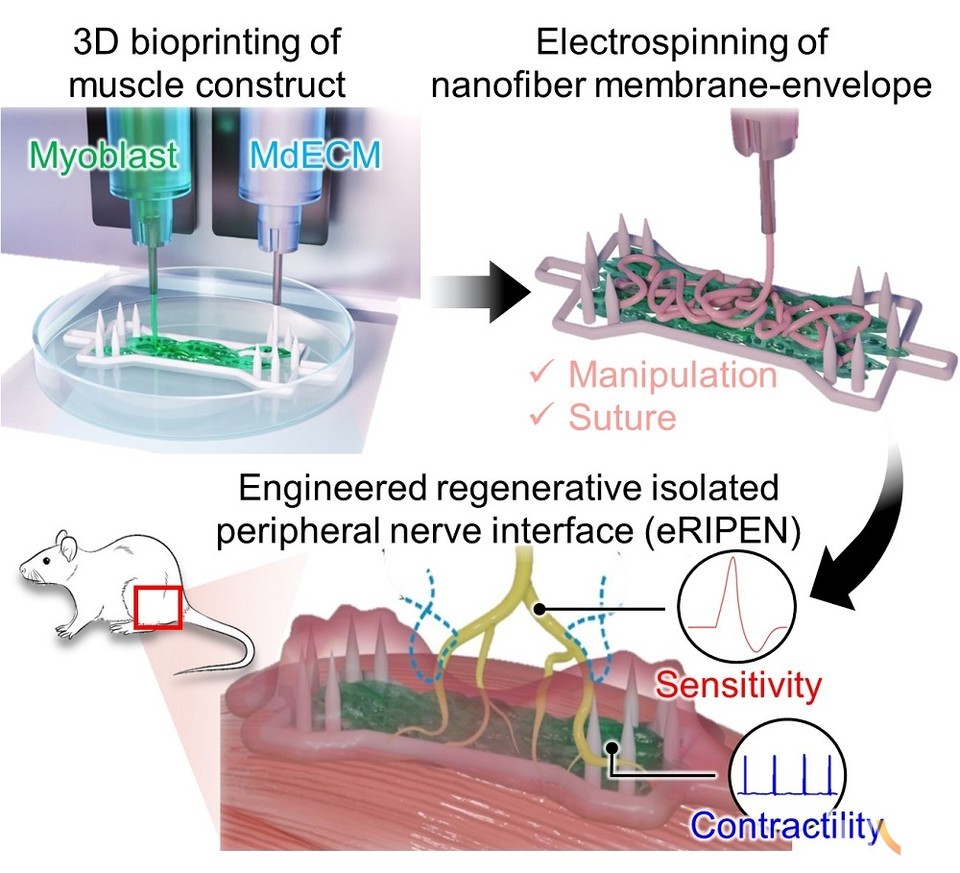 본 연구를 통해 개발된 신경-근육 재생 구조체(eRIPEN)의 제작 이미지.본 연구는 자가 신경 이식을 통해 기능적인 신경 및 근육 재생이 가능함을 확인했으며, 통증 억제에도 효과적이며 운동/감각 기능의 동시적 효과를 기대할 수 있는 신개념의 신경-근육 재생 구조체를 개발했다는 데에 창의성과 혁신성이 높음.