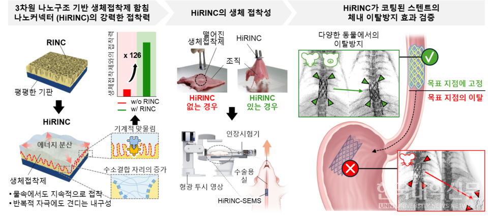 3차원 나노구조 기반 생체접착제 함침 나노커넥터(HiRINC)의 접착력 향상 및 HiRINC가 코팅된 스텐트의 체내 이탈방지 효과 모식도3차원 나노구조 기반 생체접착제 함침 나노커넥터의 강력한 접착력 메커니즘; HiRINC의 생체 접착성 검증; HiRINC가 코팅된 스텐트의 체내 이탈방지 효과 검증 그림설명 및 그림제공 : 한양대학교 이준석 교수